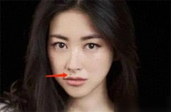 三處有痣菩薩轉世是哪三處（佛緣深厚，非迷信）